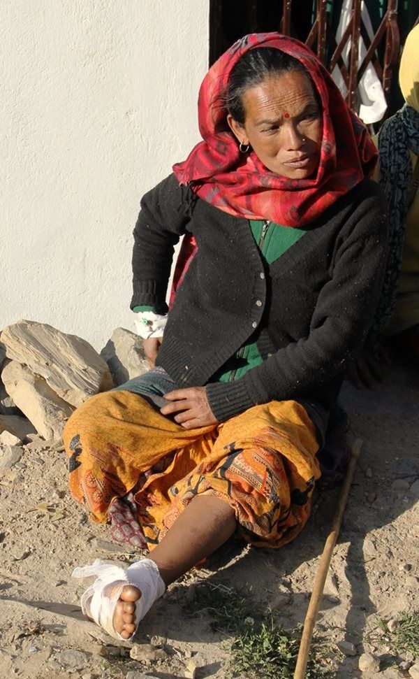 Une Népalaise est soignée pour une blessure au pied. 
