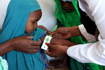 Un enfant se fait tester pour la malnutrition dans une clinique médicale